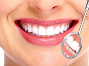 TOOTH WHITENING 